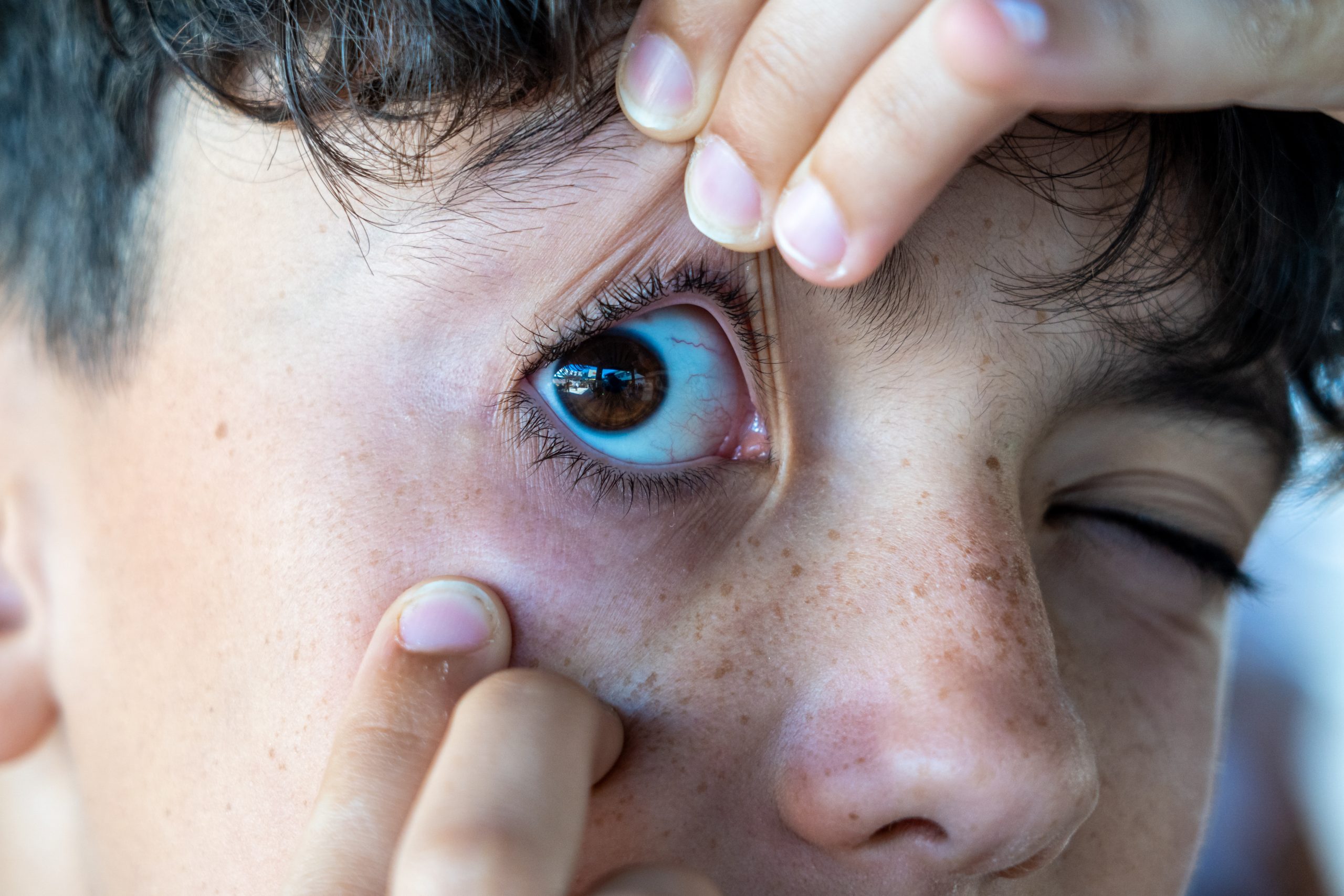 Dr. Joseph Schkolnick providing emergency eye care at Caldwell Vision Center